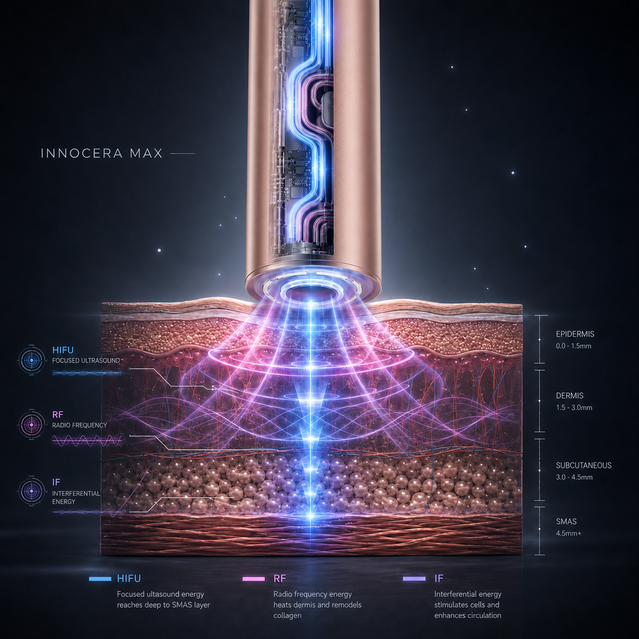 Visualisering av Innocera Max-tekniken som visar riktad energi under huden
