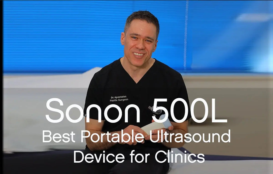 Best-Portable-Ultrasound-Device-for-Clinics-Healcerion-Sonon-500L Pure Tone Aesthetics