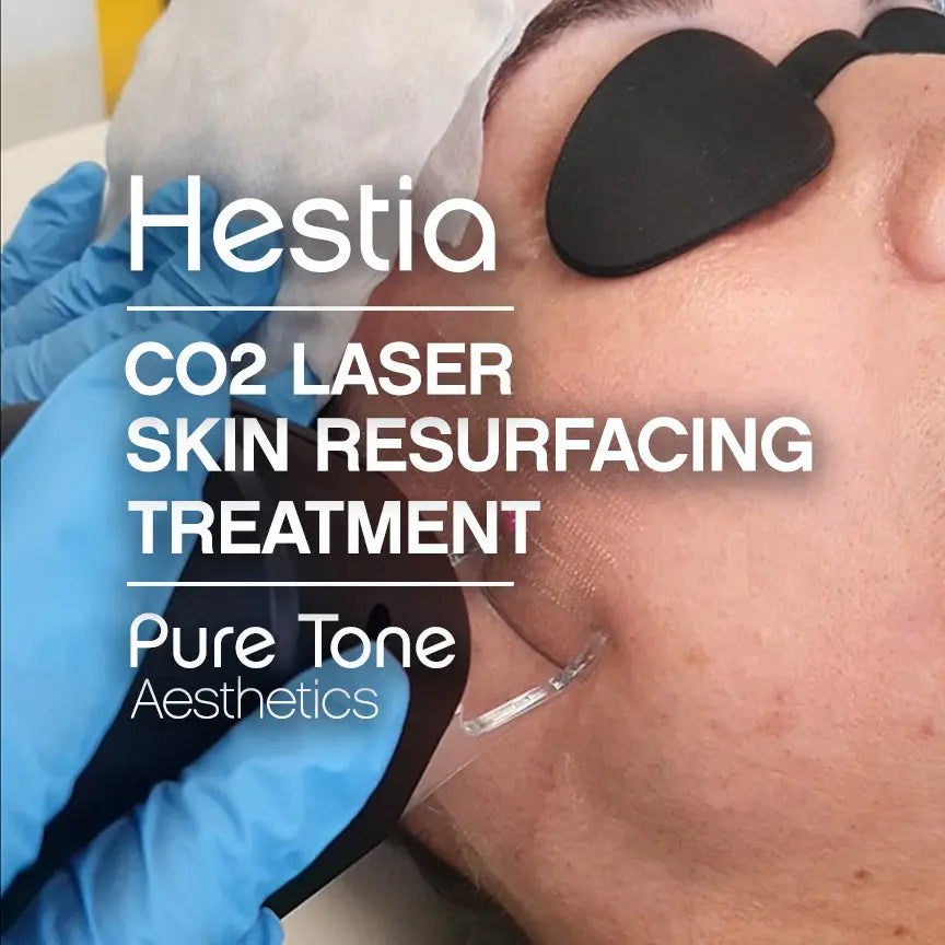 Laser Skin Resurfacing | Watch Hestia CO2 Laser Treatment - Pure Tone ...