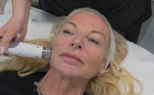 RF Microneedling Machines Explained | How RF Microneedling Works