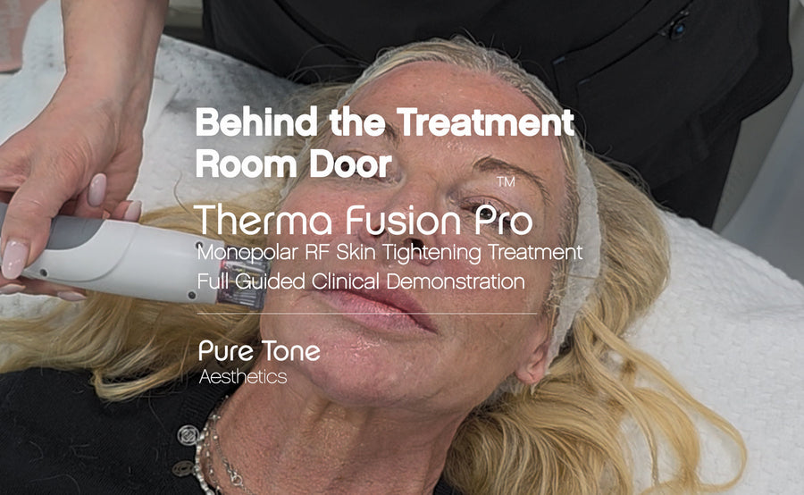 Monopolar RF Skin Tightening Treatment Demonstration | Therma Fusion Pro