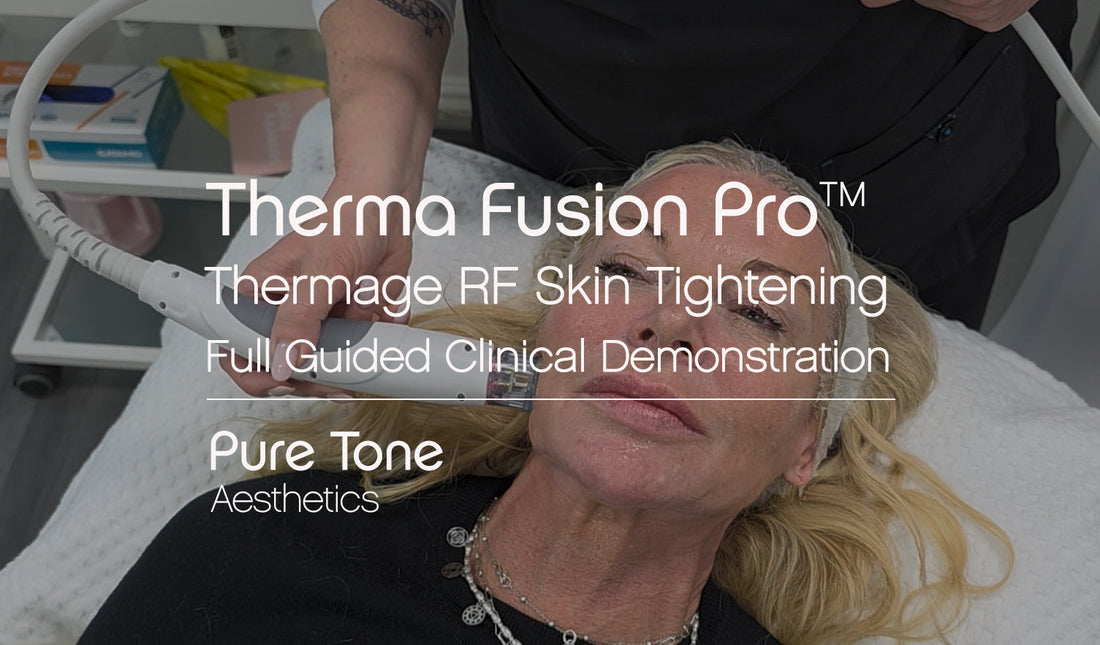 Thermage RF Treatment Demonstration Using Therma Fusion Pro™