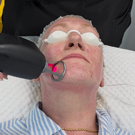What Is A Dual-Wavelength Thulium & Erbium Glass Laser?