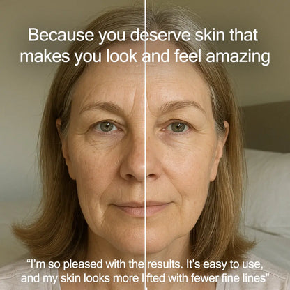 Radiance Pod 7-in-1 Skin Lifting & Tightening Tool with Face-Up Gliding Gel Pure Tone Aesthetics