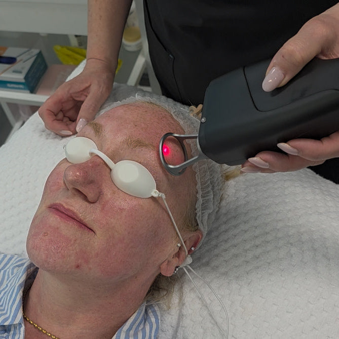 Paciente recibiendo un tratamiento profesional de rejuvenecimiento facial con Láser Thulium Pro™ en clínica